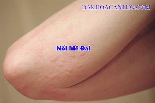 Noi me dai