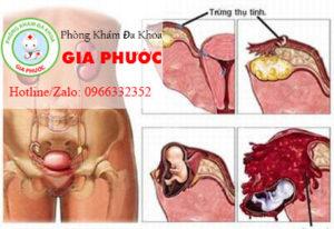 viem vung chau nguyen nhan va cach phong ngua
