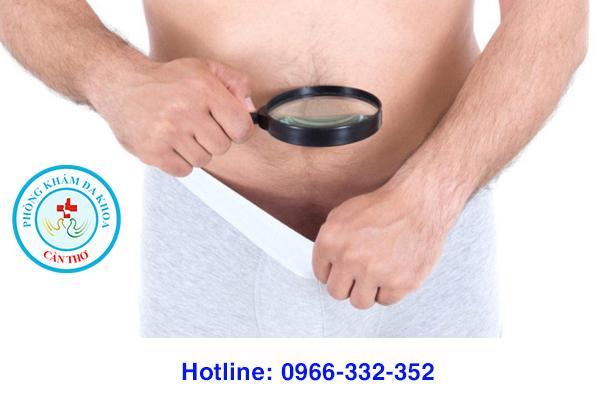 chọn mặc loại quần rộng thoáng sau khi cắt bao quy đầu